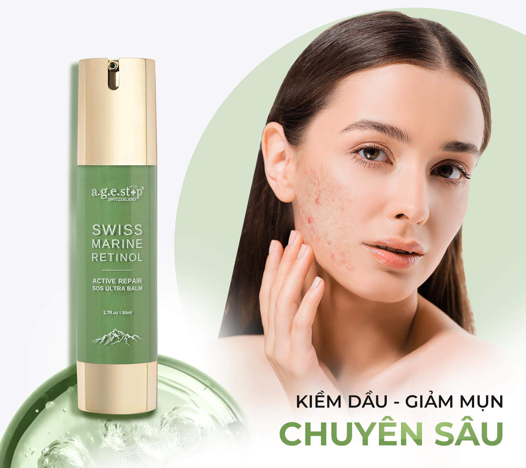 Da dầu mụn - lỗ chân lông to